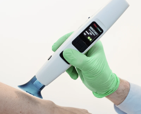 ViroCAP Behandlung Haut