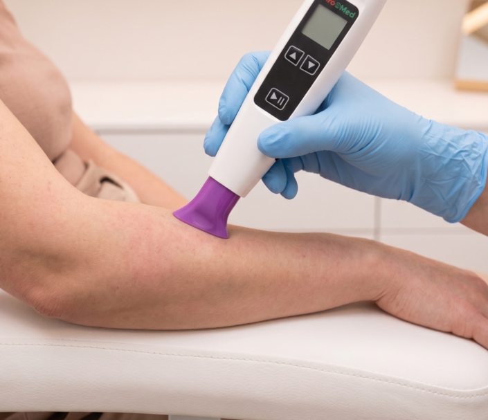 Kaltplasmatherapie