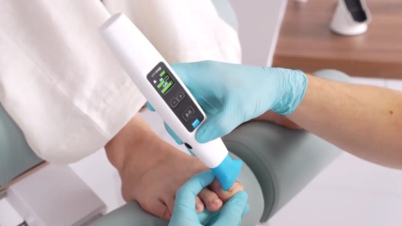 Vorschaubild: Kaltplasmatherapie in der Podologie